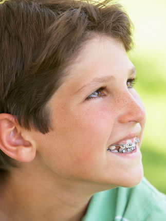 early orthodontic treatment